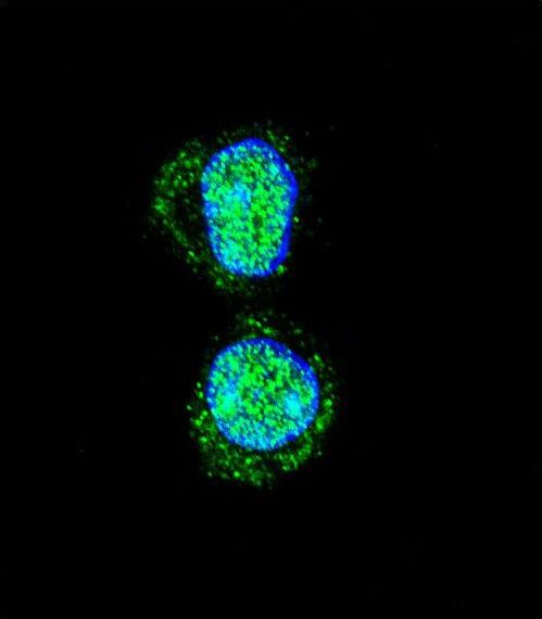 Confocal immunofluorescent of HOXA10 Antibody with HepG2 cell followed by Alexa Fluor 488-conjugated goat anti-rabbit lgG (green). DAPI was used to stain the cell nuclear (blue).