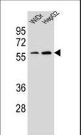 HOXA10 Antibody western blot of WiDr,HepG2 cell line lysates (35 ug/lane). The HOXA10 antibody detected the HOXA10 protein (arrow).
