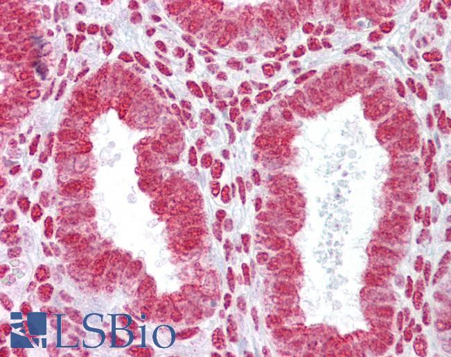 Anti-HOXA11 antibody IHC of human uterus. Immunohistochemistry of formalin-fixed, paraffin-embedded tissue after heat-induced antigen retrieval. Antibody LS-B6805 concentration 5 ug/ml.