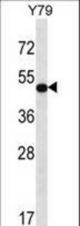 HOXA13 Antibody western blot of Y79 cell line lysates (35 ug/lane). The HOXA13 antibody detected the HOXA13 protein (arrow).