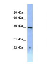 HOXA2 antibody LS-C145849 Western blot of ACHN Cell lysate. Antibody concentration 1 ug/ml.