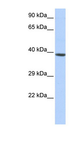 HOXA2 antibody LS-C101711 Western blot of Jurkat lysate.