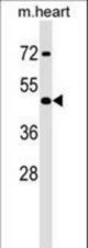Mouse Hoxa2 Antibody western blot of mouse heart tissue lysates (35 ug/lane). The Hoxa2 antibody detected the Hoxa2 protein (arrow).