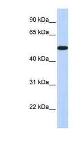 HOXA3 antibody LS-C110113 Western blot of Fetal Brain lysate.