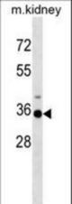 Mouse Hoxa3 Antibody western blot of mouse kidney tissue lysates (35 ug/lane). The Hoxa3 antibody detected the Hoxa3 protein (arrow).