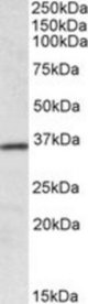 HOXA4 antibody (0.1 ug/ml) staining of Human Colon lysate (35 ug protein/ml in RIPA buffer). Primary incubation was 1 hour. Detected by chemiluminescence.