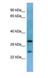 HOXA6 antibody Western Blot of Mouse Heart.