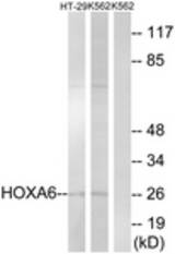 Western blot of extracts from HT-29/K562 cells, using HOXA6 Antibody. The lane on the right is treated with the synthesized peptide.