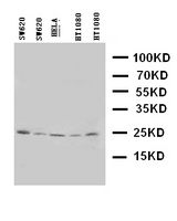 WB of HOXA6 antibody. Lane 1ï¼šSW620 Cell Lysate. Lane 2: SW620 Cell Lysate. Lane 3ï¼šHELA Cell Lysate. Lane 4ï¼šHT1080 Cell Lysate. Lane 5ï¼šHT1080 Cell Lysate.
