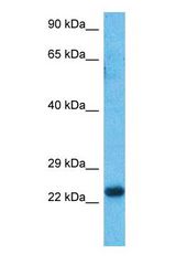 Western blot of HXA6 Antibody with human Fetal Liver lysate.