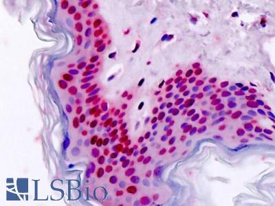 Human, Skin: Formalin-Fixed Paraffin-Embedded (FFPE)