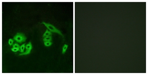 Immunofluorescence of A549 cells, using GPR12 Antibody. The picture on the right is treated with the synthesized peptide.