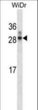 Rat Hoxa7 Antibody western blot of WiDr cell line lysates (35 ug/lane). The Hoxa7 antibody detected the Hoxa7 protein (arrow).