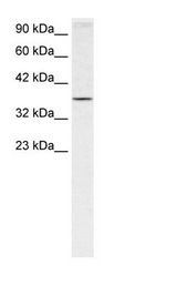 Jurkat Cell Lysate