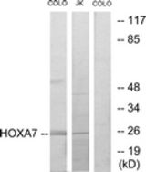 Western blot of extracts from COLO205/Jurkat cells, using HOXA7 Antibody. The lane on the right is treated with the synthesized peptide.