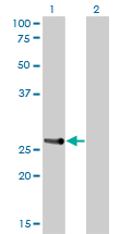Western Blot analysis of HOXA7 expression in transfected 293T cell line by HOXA7 monoclonal antibody (M01), clone 2F2.Lane 1: HOXA7 transfected lysate(25.4 KDa).Lane 2: Non-transfected lysate.