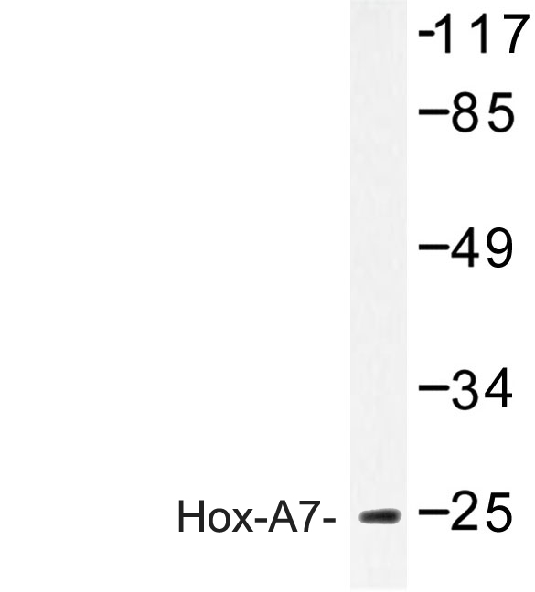 Western blot of Hox-A7 (G127) pAb in extracts from COLO205 cells.