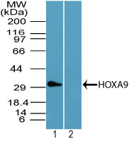 Western blot of HOXA9 in human kidney lysate in the 1) absence and 2) presence of immunizing peptide using LS-C148596 at 1 ug/ml. Goat anti-rabbit Ig HRP secondary antibody, and PicoTect ECL substrate solution, were used for this test.