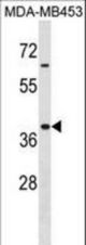 Mouse Hoxa9 Antibody western blot of MDA-MB453 cell line lysates (35 ug/lane). The Mouse Hoxa9 Antibody detected the Mouse Hoxa9 protein (arrow).