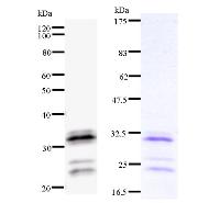 Left : Western blot analysis of immunized recombinant protein, using anti-HOXA9 monoclonal antibody. Right : CBB staining of immunized recombinant protein.