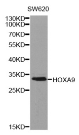 Western blot analysis of extracts of SW620 cell line, using HOXA9 antibody.