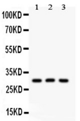 HOXA9 antibody Western blot. All lanes: Anti HOXA9 at 0.5 ug/ml. Lane 1: Rat Testis Tissue Lysate at 50 ug. Lane 2: HEPG2 Whole Cell Lysate at 40 ug. Lane 3: HEPA Whole Cell Lysate at 40 ug. Predicted band size: 30 kD. Observed band size: 30 kD.