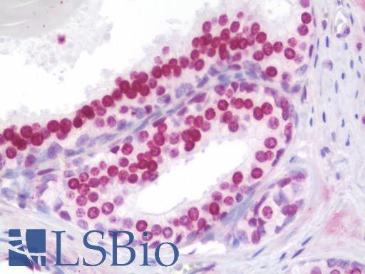 Anti-HOXA9 antibody IHC staining of human prostate. Immunohistochemistry of formalin-fixed, paraffin-embedded tissue after heat-induced antigen retrieval. Antibody LS-B10715 dilution 1:75.