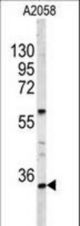 Western blot of HOXA9 Antibody in A2058 cell line lysates (35 ug/lane). HOXA9 (arrow) was detected using the purified antibody.