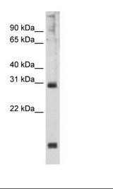 SP2/0 Cell Lysate