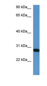 HOXB1 antibody LS-C134932 Western blot of Mouse Heart lysate.