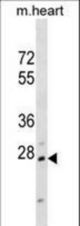 Mouse Hoxb1 Antibody western blot of mouse heart tissue lysates (35 ug/lane). The Hoxb1 antibody detected the Hoxb1 protein (arrow).