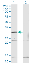 Western blot of HOXB1 expression in transfected 293T cell line by HOXB1 monoclonal antibody (M13), clone 2E5.