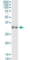 Immunoprecipitation of HOXB1 transfected lysate using anti-HOXB1 monoclonal antibody and Protein A Magnetic Bead.