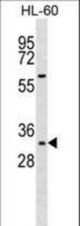Mouse Hoxb13 Antibody western blot of HL-60 cell line lysates (35 ug/lane). The Hoxb13 antibody detected the Hoxb13 protein (arrow).