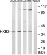 Western blot of extracts from MCF-7/HUVEC/A549/LOVO cells, using HOXB2 Antibody. The lane on the right is treated with the synthesized peptide.