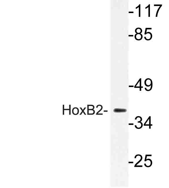 Western blot of HoxB2 (P67) pAb in extracts from LOVO cells.
