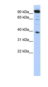 HOXB2 antibody LS-C101558 Western blot of HepG2 cell lysate.