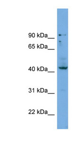 HOXB3 antibody LS-C116765 Western blot of NCI-H226 cell lysate.