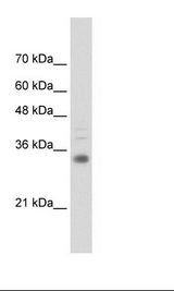 Transfected 293T Cell Lysate