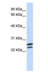 HOXB4 antibody Western Blot of Jurkat.