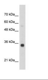Transfected 293T Cell Lysate
