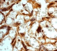 IHC of paraffin-embedded human placenta using anti-HoxB4 antibody