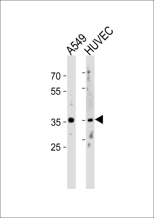 HOXB5 Antibody western blot of A549,HUVEC cell line lysates (35 ug/lane). The HOXB5 antibody detected the HOXB5 protein (arrow).