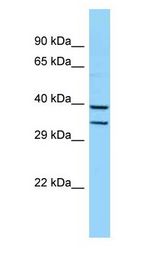 HOXB5 antibody Western Blot of Mouse Liver.