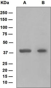 Western blot analysis on (A) fetal lung and (B) fetal kidney lysates using anti-HoxB5 antibody.