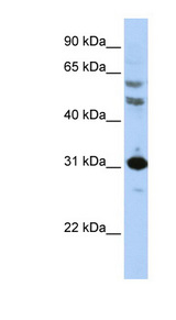 HOXB5 antibody LS-C102739 Western blot of HepG2 cell lysate.