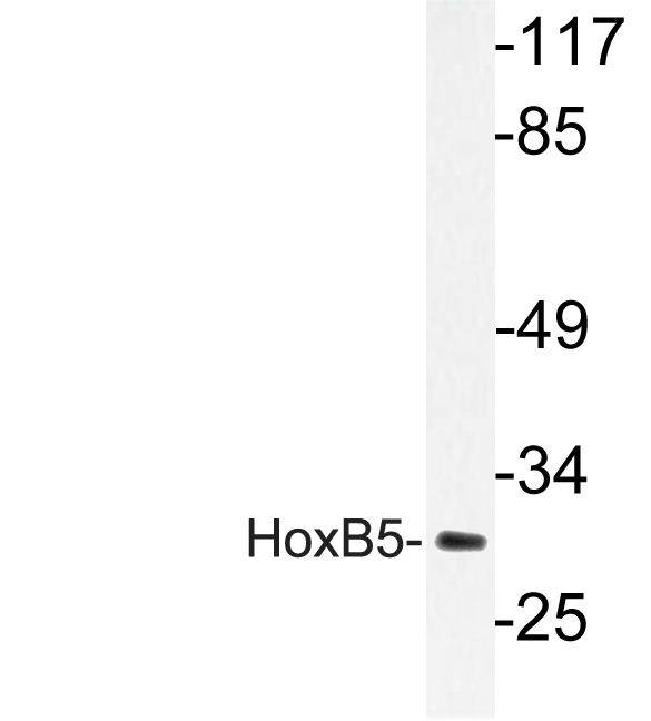 Western blot of HoxB5 (T199) pAb in extracts from HUVEC cells.