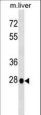 Mouse Hoxb5 Antibody western blot of mouse liver tissue lysates (35 ug/lane). The Hoxb5 antibody detected the Hoxb5 protein (arrow).