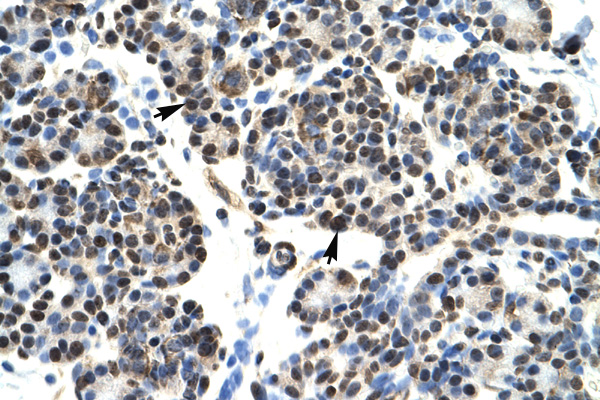 HOXB5 antibody LS-C29787 IHC of formalin-fixed, paraffin-embedded human Pancreas. Positive label: Epithelial cells of pancreatic acinus indicated with arrows. Antibody concentration 4-8 ug/ml. Magnification 400X.