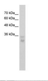 HepG2 Cell Lysate